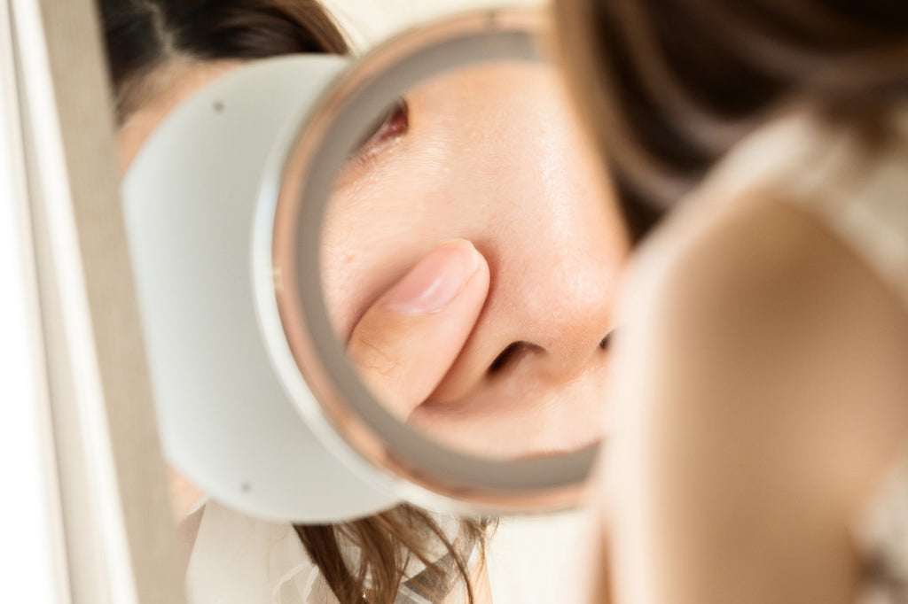 How to Remove Blackheads Like a Pro