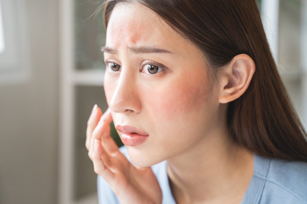 5 Skincare Products to Combat Dry and Flaky Skin