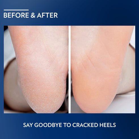 Vaseline Deep Moisture Foot Cream 55g